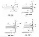 Fig. 11 - Mechanisms and methods used in the anastomosis of biological conduits