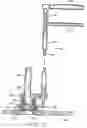 Fig. 12 - Devices and methods for performing a vascular anastomosis