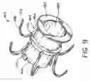 Fig. 14 - Devices and methods for performing a vascular anastomosis