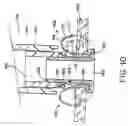Fig. 15 - Devices and methods for performing a vascular anastomosis