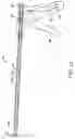 Fig. 18 - Devices and methods for performing a vascular anastomosis