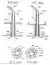 Fig. 34 - Devices and methods for performing a vascular anastomosis