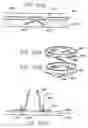 Fig. 50 - Devices and methods for performing a vascular anastomosis