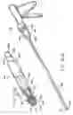 Fig. 60 - Devices and methods for performing a vascular anastomosis