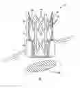 Fig. 01 - Trocar for use in deploying an anastomosis device and method of performing anastomosis