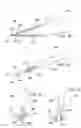 Fig. 13 - Trocar for use in deploying an anastomosis device and method of performing anastomosis