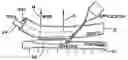 Fig. 01 - Arrangement and method for vascular anastomosis