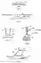 Fig. 04 - Arrangement and method for vascular anastomosis
