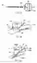 Fig. 06 - Arrangement and method for vascular anastomosis