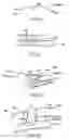 Fig. 07 - Arrangement and method for vascular anastomosis