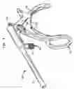 Fig. 02 - Method and device for cutting surgical wire or cable