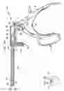 Fig. 04 - Method and device for cutting surgical wire or cable
