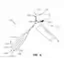 Fig. 07 - GUIDED OSTEOTOMES