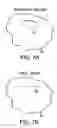 Fig. 12 - Dermal punch device