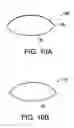 Fig. 15 - Dermal punch device