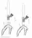 Fig. 11 - Valve bypass graft device, tools, and method