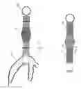 Fig. 13 - Valve bypass graft device, tools, and method