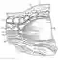 Fig. 01 - Method for surgical dissection, sizing and expansion
