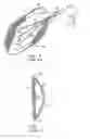 Fig. 06 - Method for surgical dissection, sizing and expansion