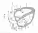 Fig. 02 - Transseptal needle