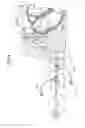 Fig. 05 - Transseptal needle