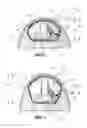 Fig. 03 - Tissue expander, system and method