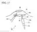 Fig. 14 - Submucosal layer dissection instrument, submucosal layer dissection system, and submucosal layer dissection method