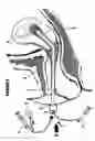 Fig. 06 - Cervical canal dilator