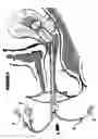 Fig. 07 - Cervical canal dilator
