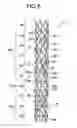 Fig. 06 - Embolus member capturing device and embolus member capturing device leaving implement