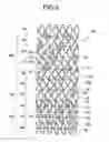 Fig. 07 - Embolus member capturing device and embolus member capturing device leaving implement