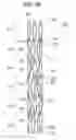 Fig. 28 - Embolus member capturing device and embolus member capturing device leaving implement