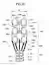 Fig. 32 - Embolus member capturing device and embolus member capturing device leaving implement