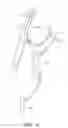 Fig. 10 - Devices and methods for preventing distal embolization using flow reversal in arteries having collateral blood flow