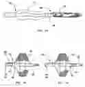Fig. 08 - Temporary intraluminal filter guidewire and methods of use