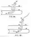 Fig. 08 - Systems and methods for sealing a vascular puncture