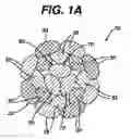Fig. 02 - High strength suture with absorbable core and suture anchor combination