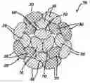 Fig. 01 - High strength suture with absorbable core