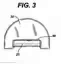 Fig. 03 - Suture anchoring device