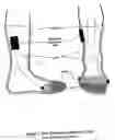 Fig. 03 - Electrical stimulation unit and waterbath system