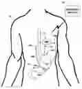 Fig. 01 - Gastric stimulation responsive to sensing feedback