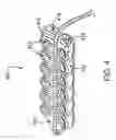 Fig. 06 - Cardiac ablation devices and methods