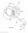 Fig. 13 - Cardiac ablation devices and methods