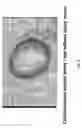 Fig. 10 - Electrical devices and anti-scarring agents