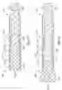 Fig. 02 - Stent delivery catheter