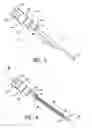 Fig. 04 - Urethral stent reducer