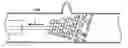 Fig. 01 - Method for treating neurovascular aneurysms