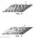 Fig. 06 - Method for treating neurovascular aneurysms