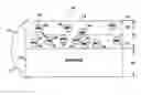 Fig. 01 - Implantable medical device