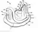 Fig. 01 - Bileaflet prosthetic valve and method of manufacture